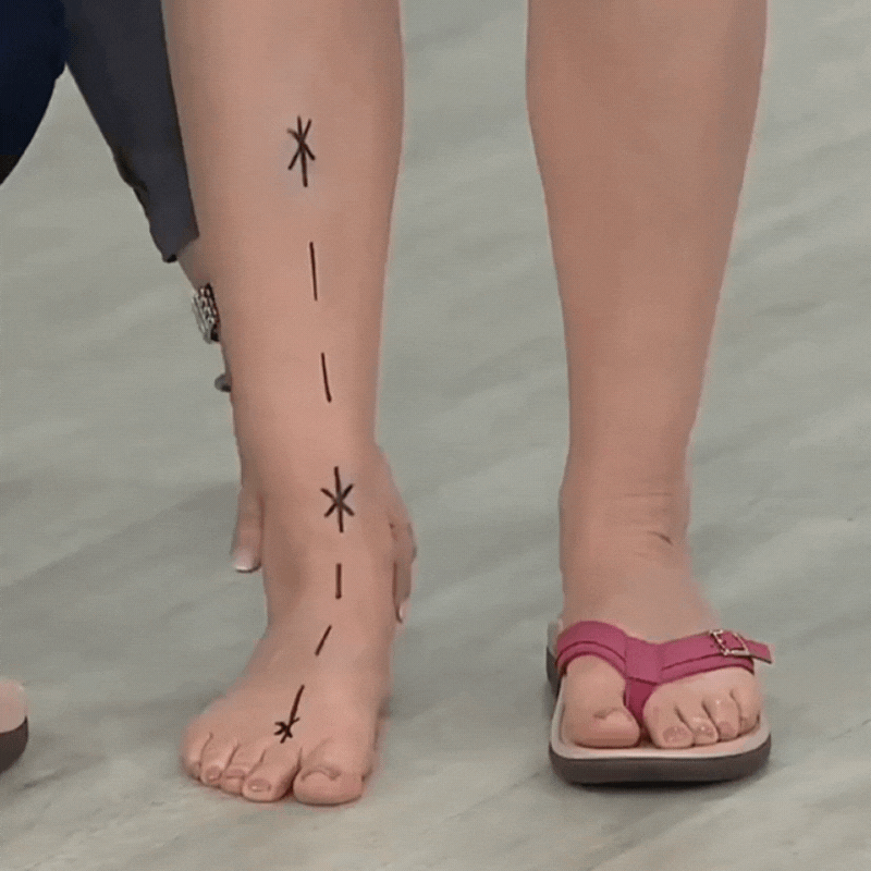 Orthopädische Damen Sommersandalen – Ergonomisches Fußbett, 3-Zonen-Support